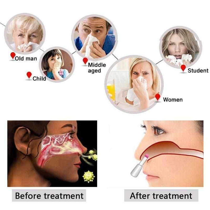 Device for the Treatment of Rhinitis and Sinusitis - Rhinitis Therapy